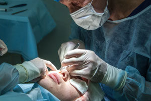 rhinoplastie tunisie